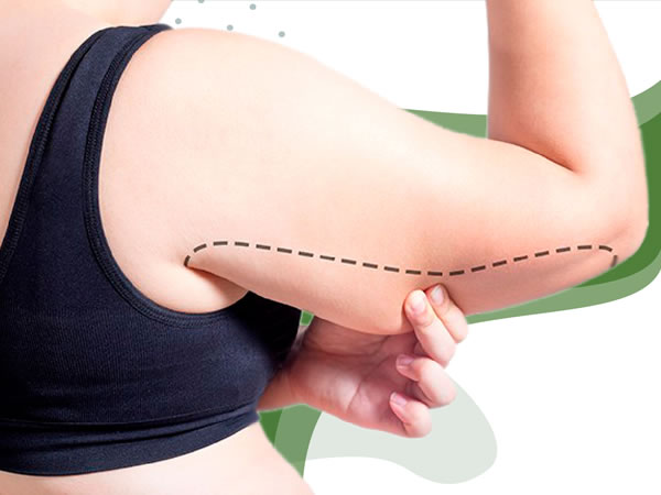 Cirugia LiftingBrazosPiernas