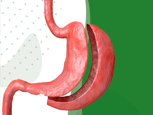 Manga Gastrica