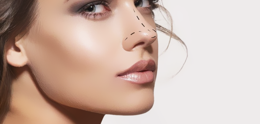 Blog 02 1000x480 1