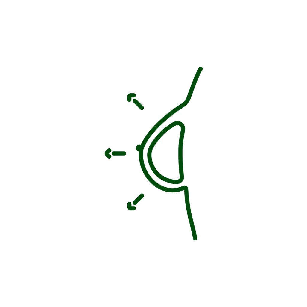 Aumento mamario Aumento mamario