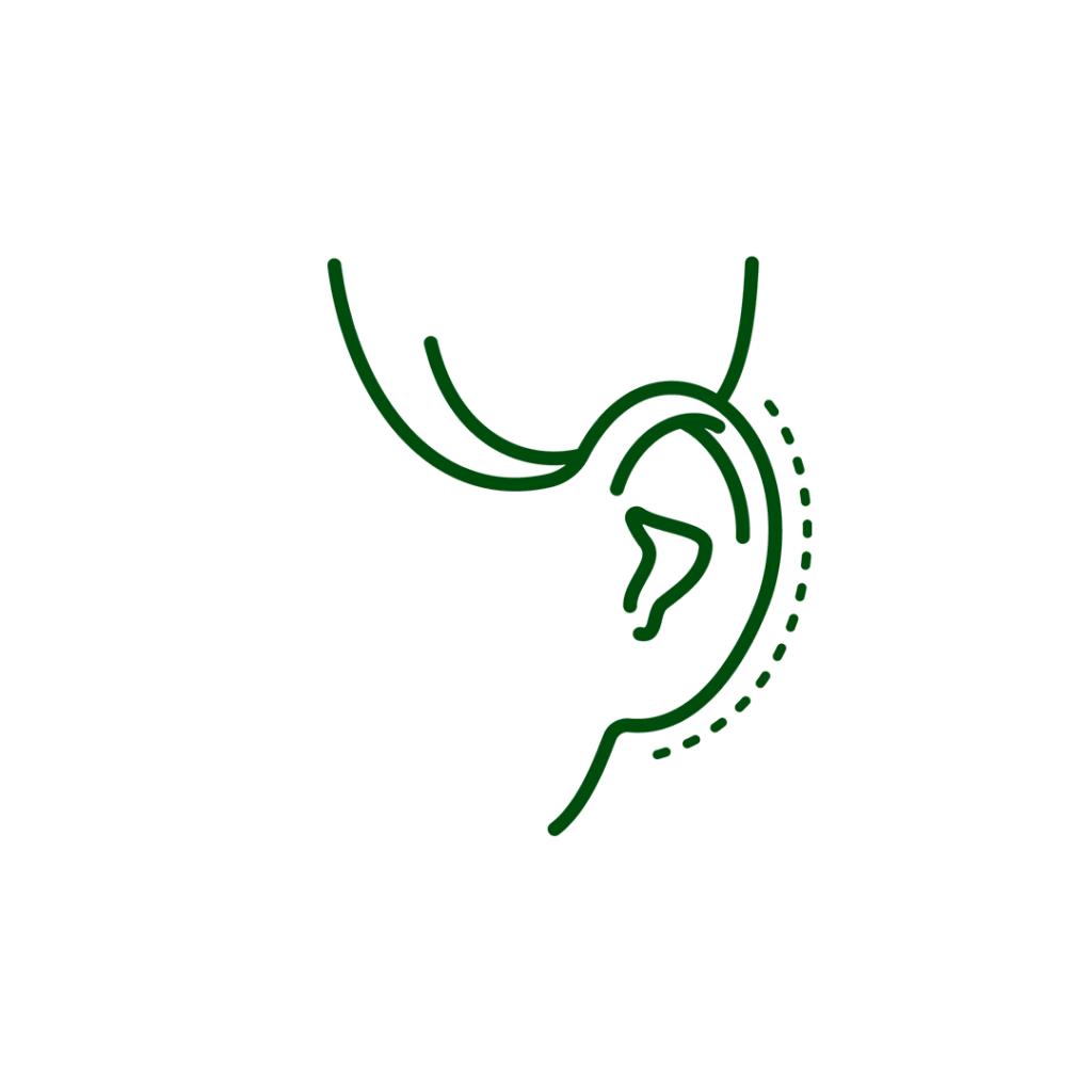 otoplastia otoplastia
